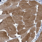 Immunohistochemical staining of human skeletal muscle shows strong cytoplasmic positivity in myocytes.