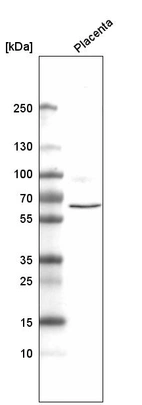 Western blot analysis in human placenta tissue.