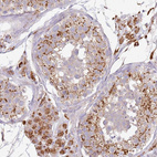 Anti-TMEM229B Antibody