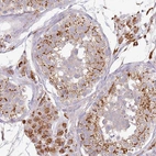 Immunohistochemical staining of human testis shows strong cytoplasmic granular positivity in cells in seminiferous ducts and in Leydig cells.