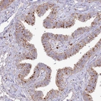 Immunohistochemical staining of human fallopian tube shows strong cytoplasmic granular positivity in glandular cells.