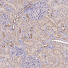 Anti-TMEM229B Antibody