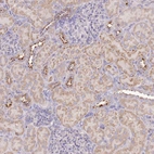 Immunohistochemical staining of human kidney shows moderate cytoplasmic granular positivity in cells in tubules.