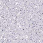 Immunohistochemical staining of human liver shows no positivity in hepatocytes as expected.