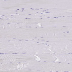 Immunohistochemical staining of human skeletal muscle shows no positivity in myocytes as expected.