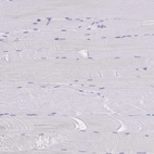 Immunohistochemical staining of human skeletal muscle shows no positivity in myocytes as expected.