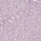 Immunohistochemical staining of human liver shows no positivity in hepatocytes as expected.