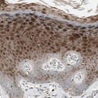 Immunohistochemical staining of human skin shows strong cytoplasmic positivity in squamous epithelial cells.