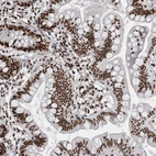 Immunohistochemical staining of human small intestine shows strong nuclear and nucleoli positivity in glandular cells and lymphoid cells.