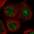 Immunofluorescent staining of human cell line A-431 shows localization to nucleus & nucleoli.