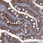 Immunohistochemical staining of human small intestine shows strong membranous-cytoplasmic positivity in glandular cells.