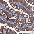 Immunohistochemical staining of human small intestine shows strong membranous-cytoplasmic positivity in glandular cells.
