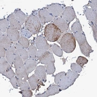 Immunohistochemical staining of human skeletal muscle shows weak membranous-cytoplasmic positivity in myocytes.