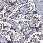 Immunohistochemical staining of human placenta shows moderate membranous-cytoplasmic positivity in trophoblastic cells.