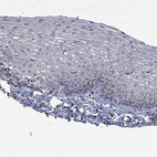 Immunohistochemical staining of human cervix, uterine shows no positivity in squamous epithelial cells as expected.