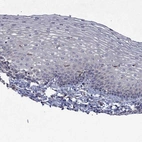 Immunohistochemical staining of human cervix, uterine shows no positivity in squamous epithelial cells as expected.