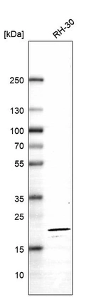 Western blot analysis in human cell line RH-30.