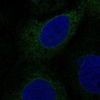 Immunofluorescent staining of human cell line CACO-2 shows localization to endoplasmic reticulum.