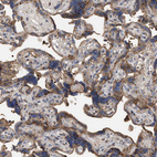 Immunohistochemical staining of human placenta shows strong cytoplasmic granular positivity in trophoblastic cells.
