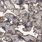 Immunohistochemical staining of human placenta shows strong cytoplasmic granular positivity in trophoblastic cells.