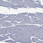 Immunohistochemical staining of human skeletal muscle shows no positivity in myocytes as expected.