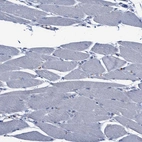Immunohistochemical staining of human skeletal muscle shows no positivity in myocytes as expected.