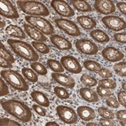 Immunohistochemical staining of human stomach shows moderate cytoplasmic positivity in glandular cells.