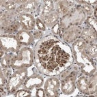 Immunohistochemical staining of human kidney shows moderate cytoplasmic positivity in cells in glomeruli cells in tubules.