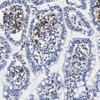 Anti-HLA-DQA1 Antibody