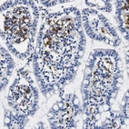 Immunohistochemical staining of human small intestine shows strong cytoplasmic positivity in lymphoid cells.