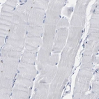 Immunohistochemical staining of human skeletal muscle shows no positivity in myocytes as expected.