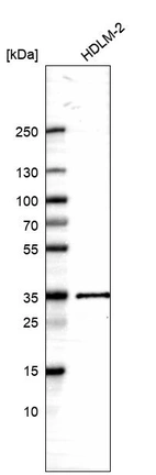 Western blot analysis in human cell line HDLM-2.