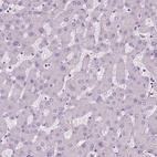 Immunohistochemical staining of human liver shows no positivity in hepatocytes as expected.