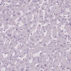 Immunohistochemical staining of human liver shows no positivity in hepatocytes as expected.