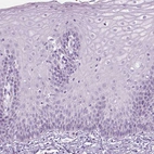 Immunohistochemical staining of human cervix, uterine shows no positivity in squamous epithelial cells as expected.