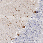 Immunohistochemical staining of human cerebellum shows strong cytoplasmic positivity in Purkinje cells.