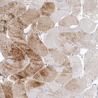 Immunohistochemical staining of human skeletal muscle shows moderate cytoplasmic positivity in myocytes.