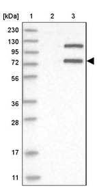 Lane 1: Marker [kDa] 230, 130, 95, 72, 56, 36, 28, 17, 11_br/_Lane 2: Human cell line RT-4_br/_Lane 3: Human cell line U-251MG sp