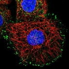 Immunofluorescent staining of human cell line A-431 shows localization to cytosol & focal adhesion sites.
