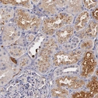 Immunohistochemical staining of human kidney shows moderate cytoplasmic granular positivity in cells in tubules.