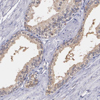 Anti-PTS Antibody