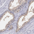 Immunohistochemical staining of human prostate shows moderate cytoplasmic positivity in glandular cells.