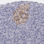Immunohistochemical staining of human pancreas shows moderate cytoplasmic positivity in islets of Langerhans.