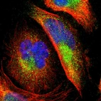Immunofluorescent staining of human cell line U-251 MG shows localization to cytosol.