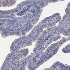 Immunohistochemical staining of human fallopian tube shows moderate cytoplasmic positivity in ciliated cells.