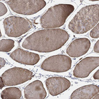 Immunohistochemical staining of human skeletal muscle shows moderate cytoplasmic positivity in myocytes.