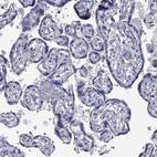 Immunohistochemical staining of human placenta shows no cytoplasmic positivity in trophoblastic cells as expected.