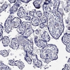 Immunohistochemical staining of human placenta shows no cytoplasmic positivity in trophoblastic cells as expected.