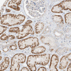 Immunohistochemical staining of human kidney shows strong cytoplasmic granular positivity in cells in tubules.