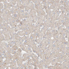 Immunohistochemical staining of human liver shows negative to very weak positivity in hepatocytes as expected.